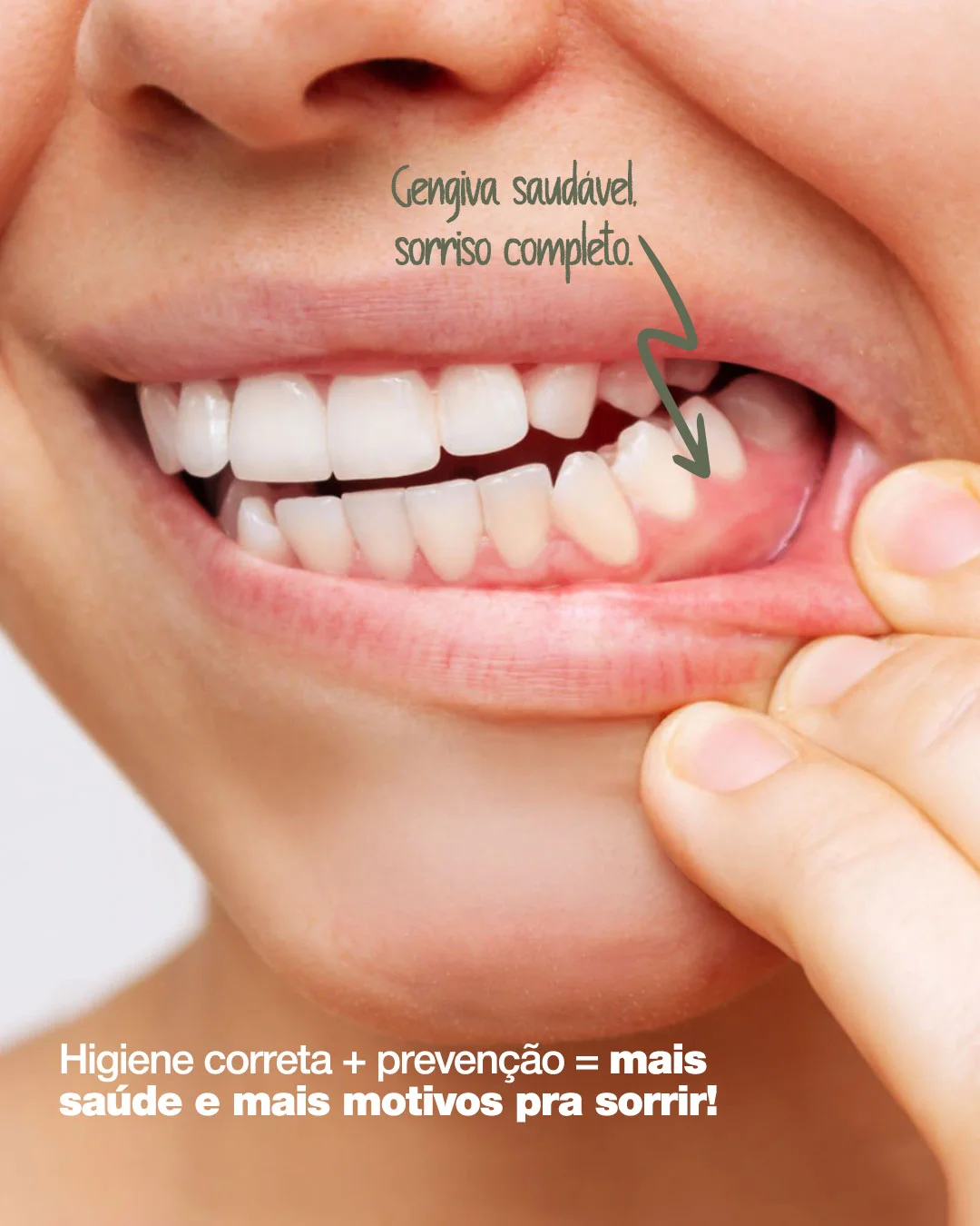 Depois